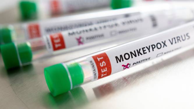 Meldplicht voor apenpokken-besmettingen na enkele gevallen in Nederland; geen druk op zorg verwacht
