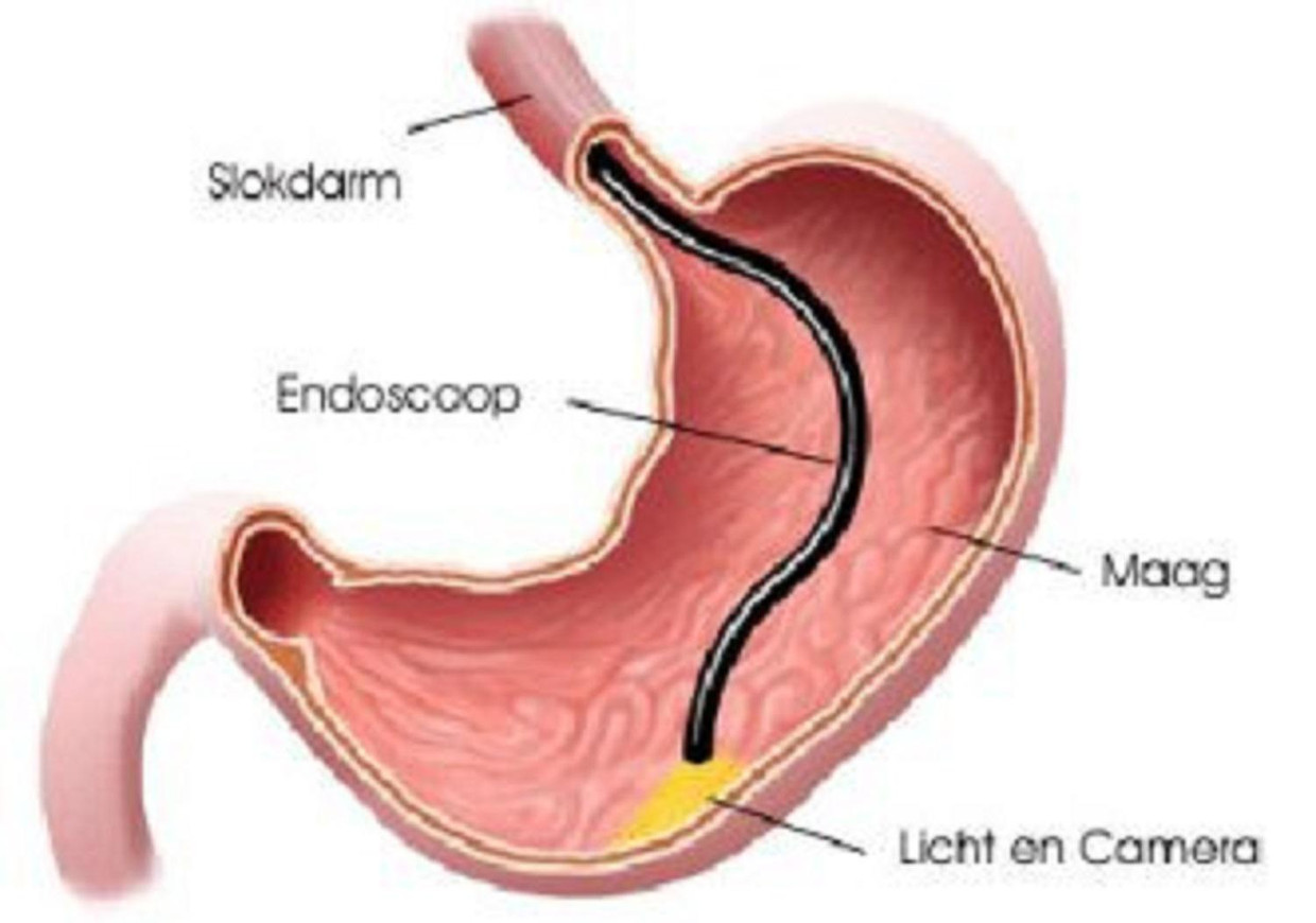 Исследования пищевода и желудка