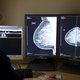 Ziekenhuis Twente markeert borstkanker zonder radioactieve straling met nieuwe methode