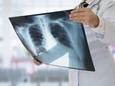 Le cancer du poumon, première cause de mortalité oncologique en Belgique, est souvent diagnostiqué à un stade avancé, lorsque les chances de guérison sont très limitées.