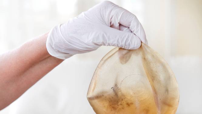 Vrouwen eisen 600 miljoen van maker ‘gevaarlijke’ borstimplantaten: ‘Ze lekken allemaal’