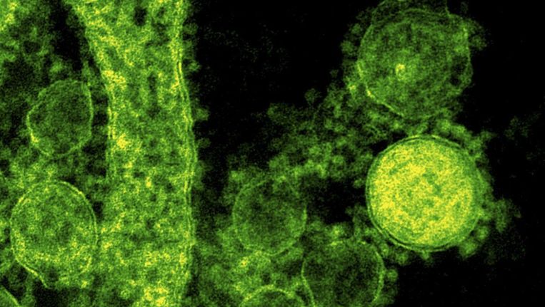 Delen van het MERS-virus op een ongedateerde ingekleurde microscopische foto. Beeld REUTERS