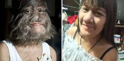 'Harigste meisje ter wereld' trouwt met de liefde van haar leven