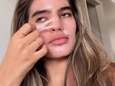 Elle fait croire que la peau pèle pendant les règles: un canular pas si drôle 