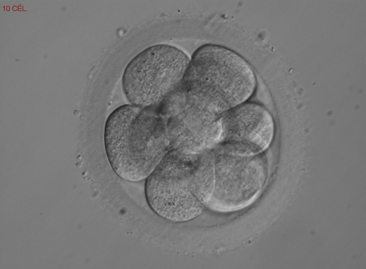 Een achtcellig embryo.  Beeld rv