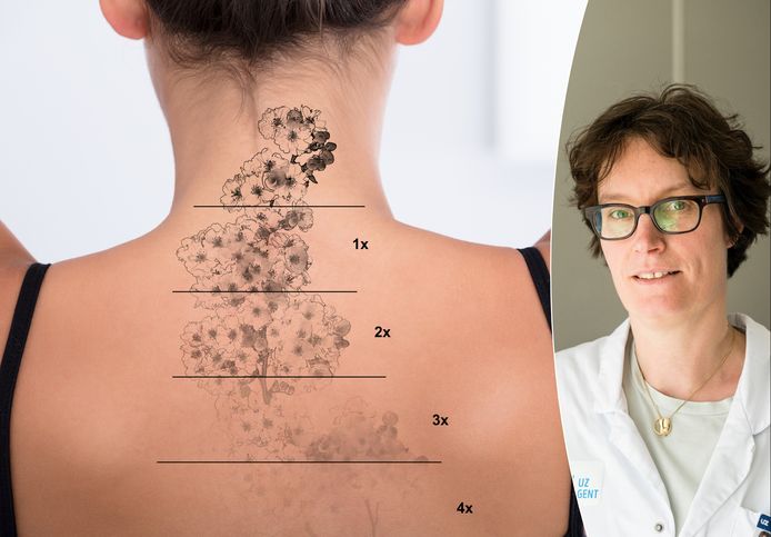 Dermatoloog Evelien Verhaeghe is gespecialiseerd in het weghalen van tatoeages.