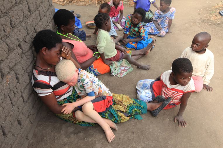 Edna Cedrick (26), links op de foto, houdt haar albinozoon vast. Zijn albino-tweelingbroer is iets eerder op gewelddadige wijze ontvoerd en vermoord. Cedrick zegt nog dagelijks achtervolgd te worden door beelden van haar negenjarige zoon die onthoofd werd. Beeld AP