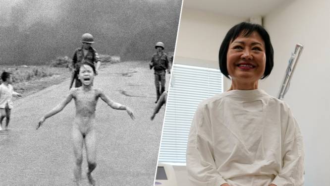 ‘Napalmmeisje’ ondergaat laatste huidbehandeling na 50 jaar: ‘Niet langer een slachtoffer van de oorlog’