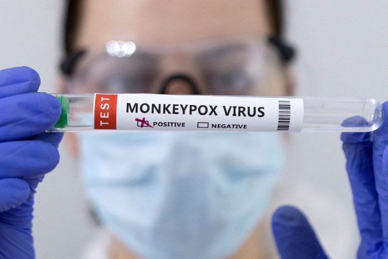 Een testtube met het apenpokkenvirus Beeld REUTERS