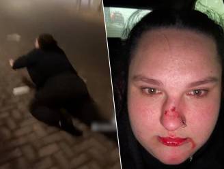 TikTok-trend van vrouw gaat fout, ze breekt haar neus en heeft zelfs operatie nodig
