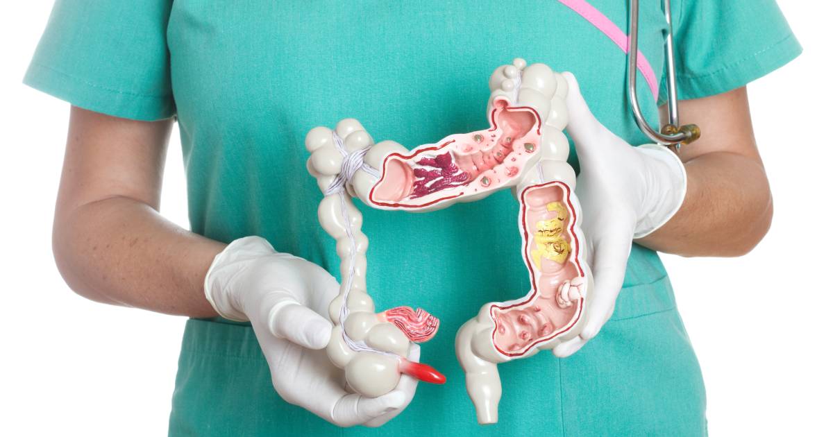 "Crohn's Disease Symptoms, Diagnosis and Treatment Expert Insights