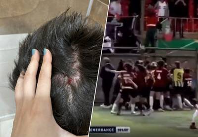 Stoppen slaan door in Turks vrouwenvoetbal: 6 rode kaarten, knokpartij en zelfs stenenregen uit tribunes