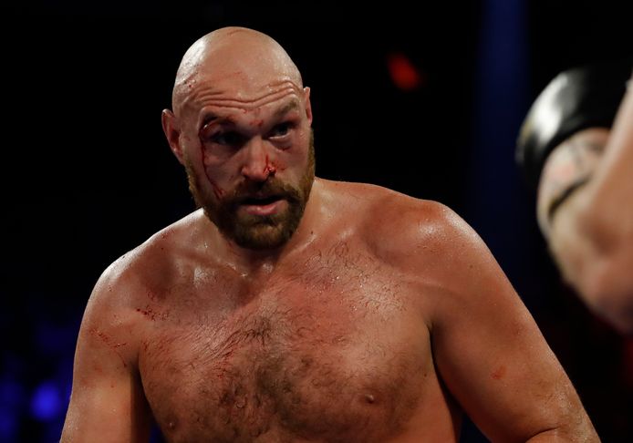 Tyson Fury.