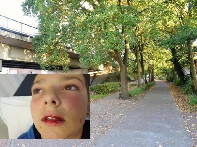 Tieners die jongen (13) hersenschudding sloegen in Roeselare opgepakt en weer vrijgelaten