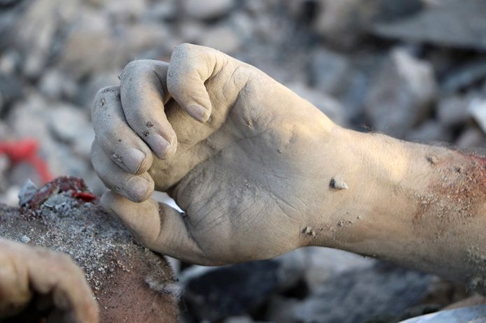 La mano di un uomo ucciso nell'attacco.