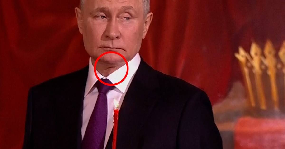 Misteriosa cicatriz genera nuevas especulaciones sobre la salud de Putin |  Noticias