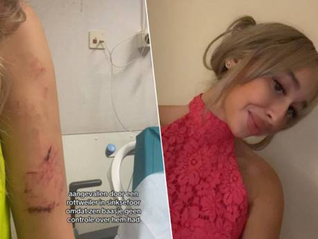 16-jarige praat over aanval door loslopende rottweiler op Sinksenfoor: “Het baasje had geen controle over zijn hond”
