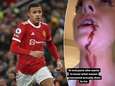 Mason Greenwood inculpé pour tentative de viol et coups et blessure