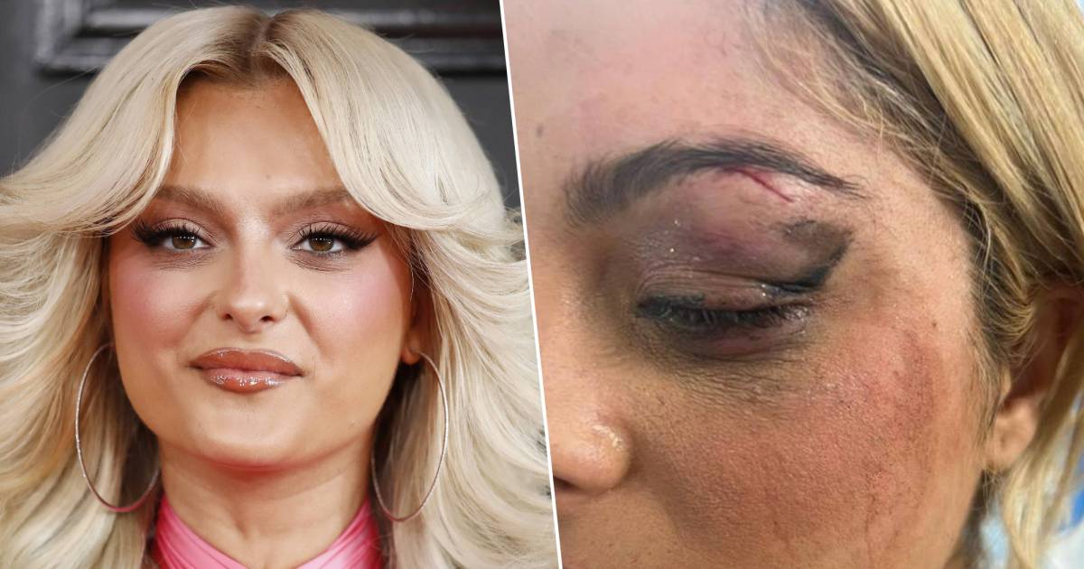 Bebe Rexha ha sparato con il telefono sul palco durante un concerto, il suo aggressore “l’ha trovato divertente” |  la gente