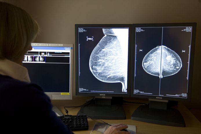 Een radioloog bekijkt digitale röntgenfoto's voor borstkankeronderzoek.