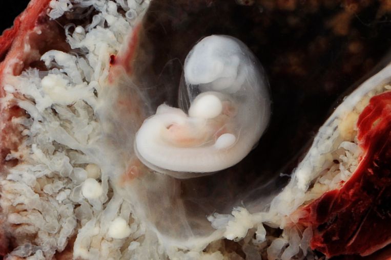 Een embryo van 3 tot 4 weken. Beeld TR Beeld