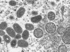 Eerste apenpokkenvirusgevallen in Zwitserland en Israël, ook Noorwegen start onderzoek naar mogelijke uitbraak