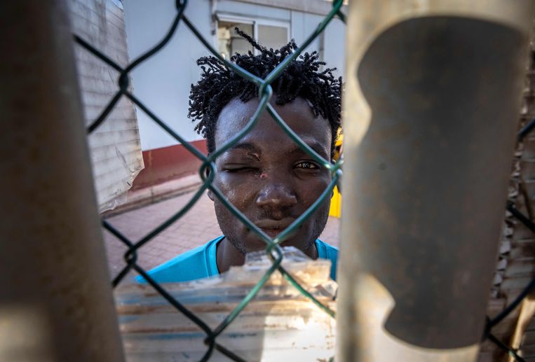 Een Soedanese migrant met een oogwond in het tijdelijke opvangcentrum voor migranten en asielzoekers in de Spaanse exclave Melilla in Marokko. Beeld AFP