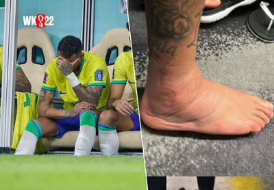 Neymar, die al zeker volgende groepsmatch tegen Zwitserland mist, deelt foto van intussen stevig gezwollen voet