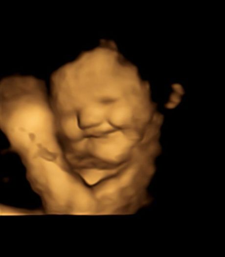 Onderzoek wijst uit: ongeboren baby's pruilen bij smaak van boerenkool en lachen bij wortels 
