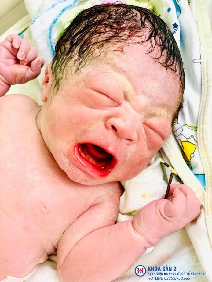 Les photos du nouveau-né ont été partagées sur Facebook par l’hôpital international de HaïPhong.