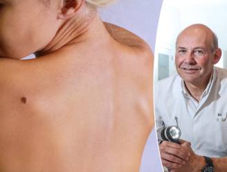 Drie soorten huidtumoren en hoe je ze kunt herkennen: “Tumoren voel je niet, waardoor het misschien niet alarmerend lijkt”
