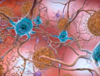 Nieuw medicijn tegen alzheimer stemt onderzoekers hoopvol: cognitieve achteruitgang bij patiënten kan vertraagd worden