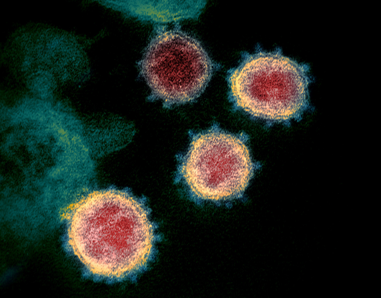 Archiefbeeld van het coronavirus onder de microscoop. Beeld via REUTERS