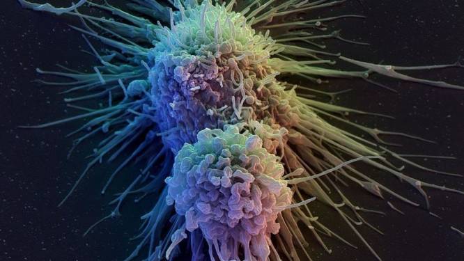 Antwerpse wetenschappers onderzoeken belang van T-cellen voor immuniteit tegen hepatitis B