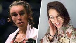 Ernstig toegetakelde kooivechtster heeft haar gezicht terug