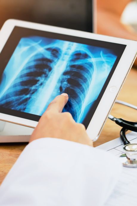 Poumon, cerveau, sein...: améliorations “impressionnantes” dans la lutte contre le cancer