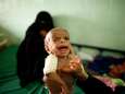 'Tienduizenden kinderen Jemen doodgehongerd'