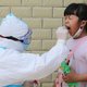 Kindersartsen zien relatie tussen coronavirus en kinderziekte Kawasaki