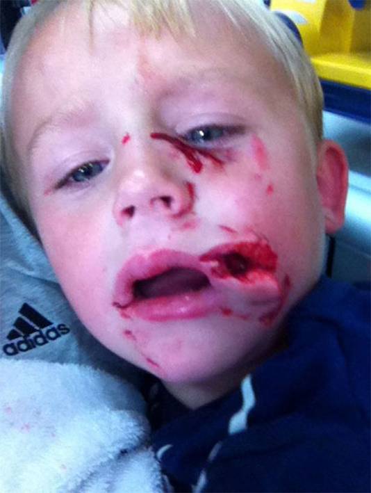 Door Hitte Bevangen Pitbull Grijpt Britse Kleuter Buitenland Ad Nl