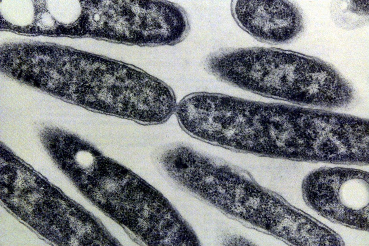 De legionella-bacterie, zo'n negenduizend keer uitvergroot. 