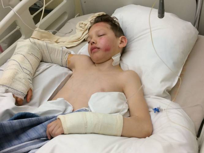 Vlaamse jongen (10) valt acht meter diep uit skilift: "Polsen en dijbeen gebroken, hersenschudding, ruggenwervel geraakt"