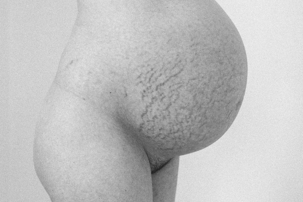 Een buik vol zwangerschapsstriemen. De expo gaat voor pure en realistische foto’s. Beeld Julie Scheurweghs
