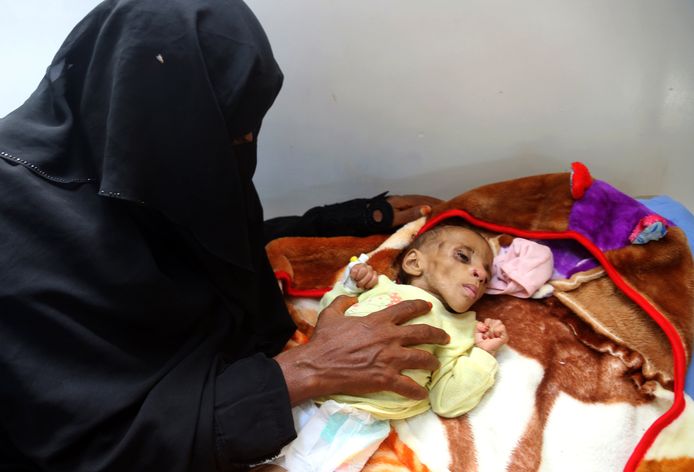 Een Jemenitische vrouw zit bij een zwaar ondervoed baby in een ziekenhuis in Hodeidah, Jemen.