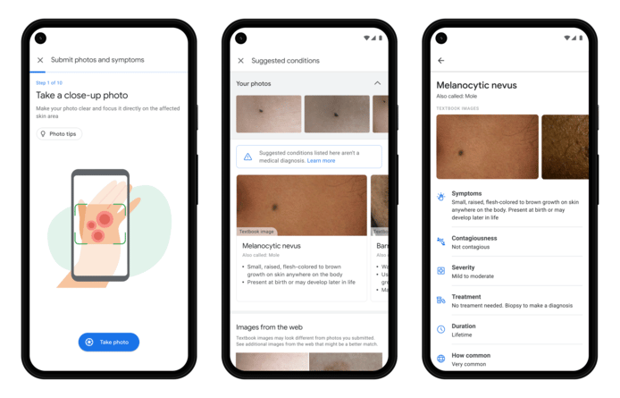 Zo werkt Derm Assist van Google.