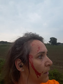 Suzanne van Vugt is aangevallen door een roofvogel in Heukelom. Hij doorboorde haar achterhoofd met zijn klauwen.
