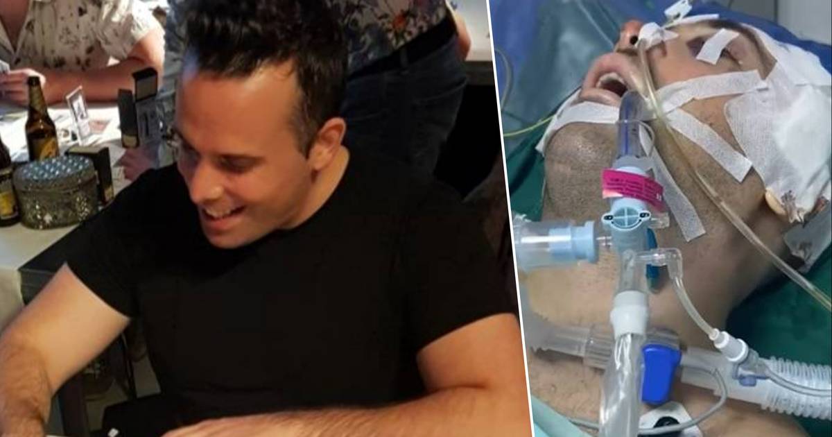 Moeder radeloos na zwaar ongeval van Jorgo op Bali: ‘Mijn zoon naar België halen, kost me ruim 2 ton’.