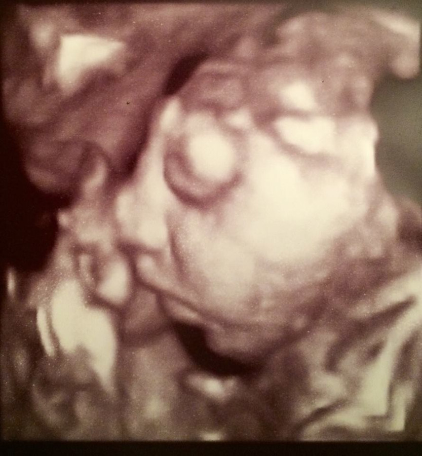 Doodzieke bucket listbaby overleden in armen