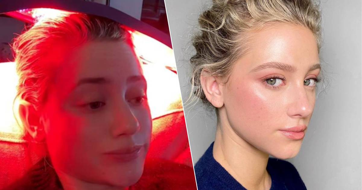 look.  Lili Reinhart opens up about her period of severe depression: “My hair is falling out.”  celebrities