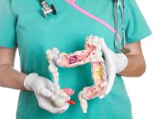 Darmziekte Crohn komt vaker voor omdat we meer bewerkt voedsel eten: wat te doen bij deze diagnose?