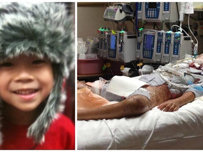 Xander (10) kreeg ibuprofen. De gevolgen voor zijn lichaam waren ronduit verwoestend